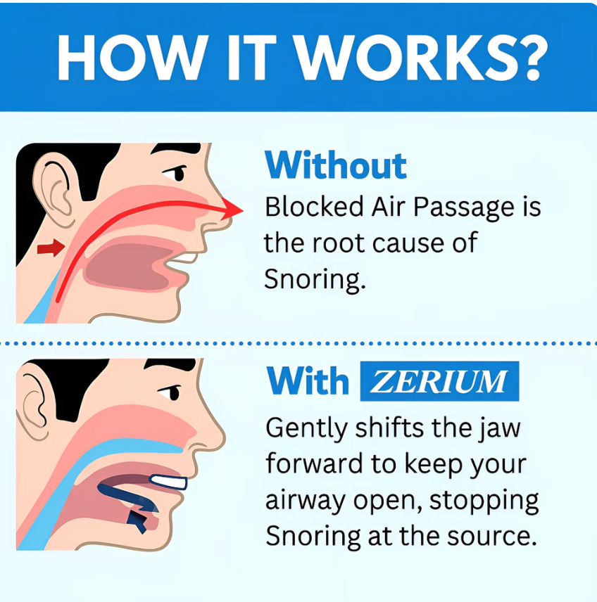 Anti-Snoring Mouthpiece
