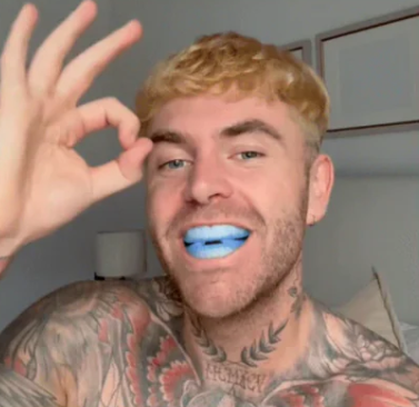Anti-Snoring Mouthpiece